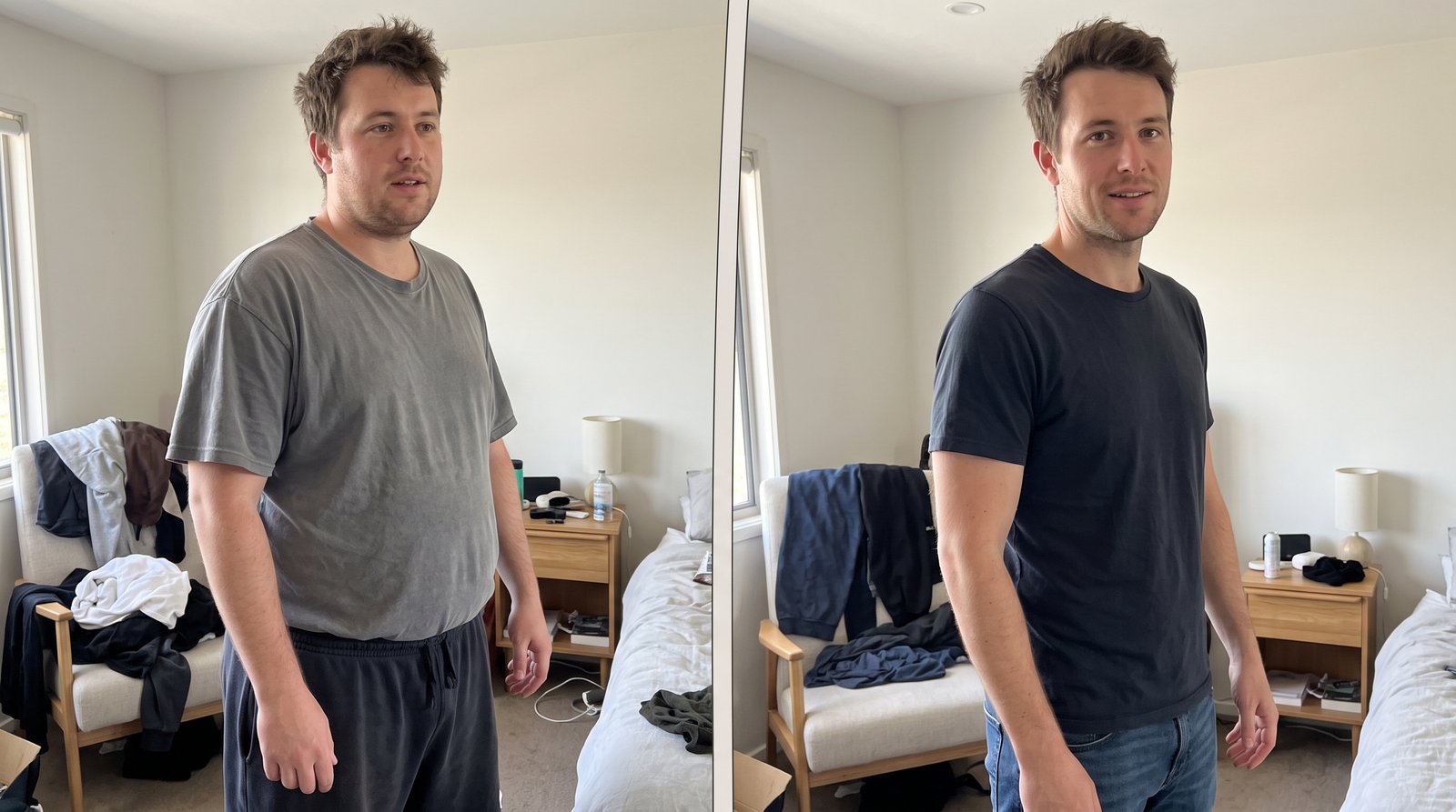 Antes e depois - Rafael